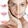 Peeling Ultrassônico Esfoliante Limpeza Facial Profunda . Skin Care perfeito em casa.